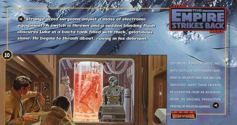 1995 Topps Widevision Star Wars: The Empire Strikes Back #10 Int. Rebel Base - Medical Center Back